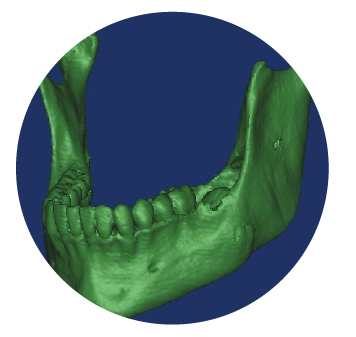servicio2 generacion de archivosSTL 02