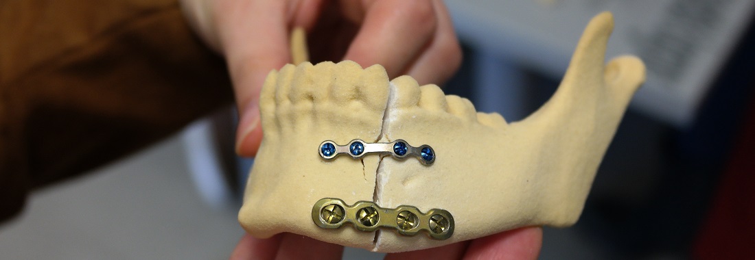 Impresión 3D Biomodelos